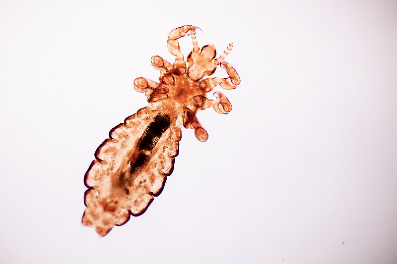 头虱(Pediculus humanuscapitis)是一种寄生于人体、人或动物身上的寄生虫，以吸血为生。