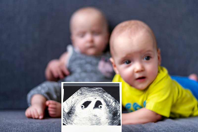 超声波照片双胞胎。背景是一对双胞胎，一个男孩和一个7个月大的女孩。孕妇。有选择性的重点。