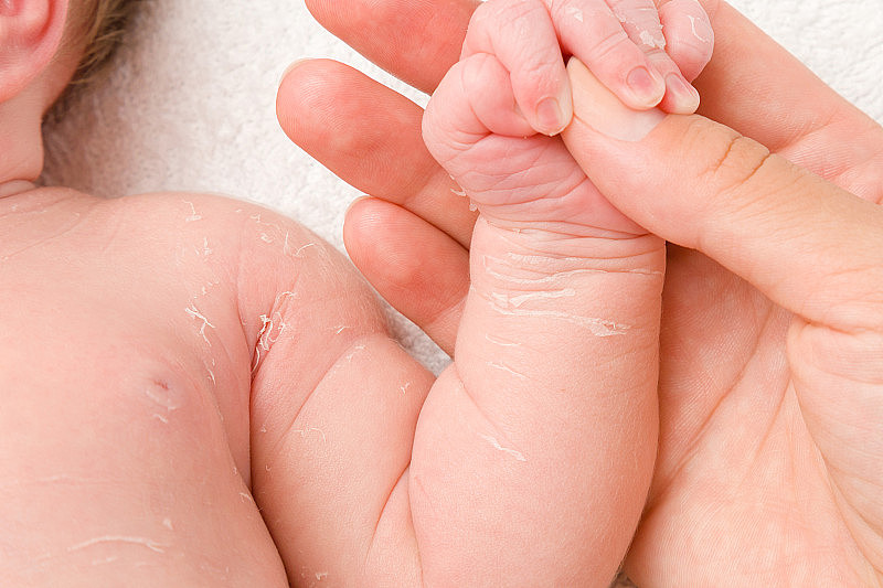 母亲的手抱着新生儿的手臂。干燥的皮肤。出生后的头几天。关爱宝宝干净柔软的身体肌肤。特写镜头。