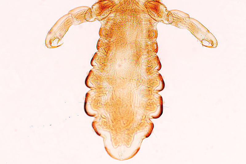 头虱(Pediculus humanus capititis)是一种寄生在人或动物身上的寄生虫，通过将血液吸进食物而生存。