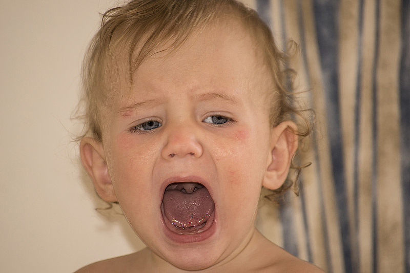 患有特应性皮炎的孩子大声呼喊，看到喉咙
