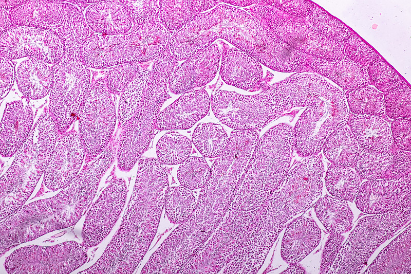 显微镜下睾丸组织横切面