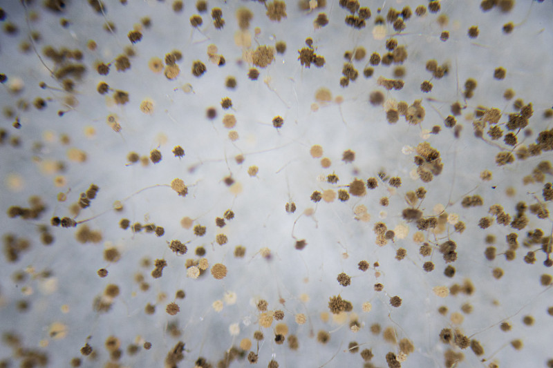 根霉(面包霉菌)在显微镜下的菌落特征