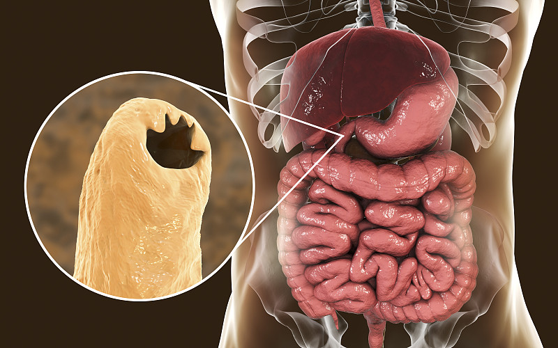人十二指肠的寄生钩虫十二指肠钩虫